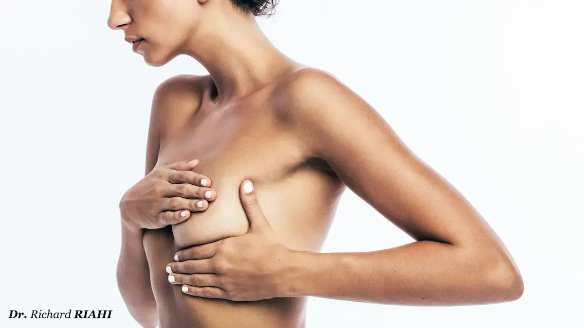 Augmentation mammaire et ptôse mammaire